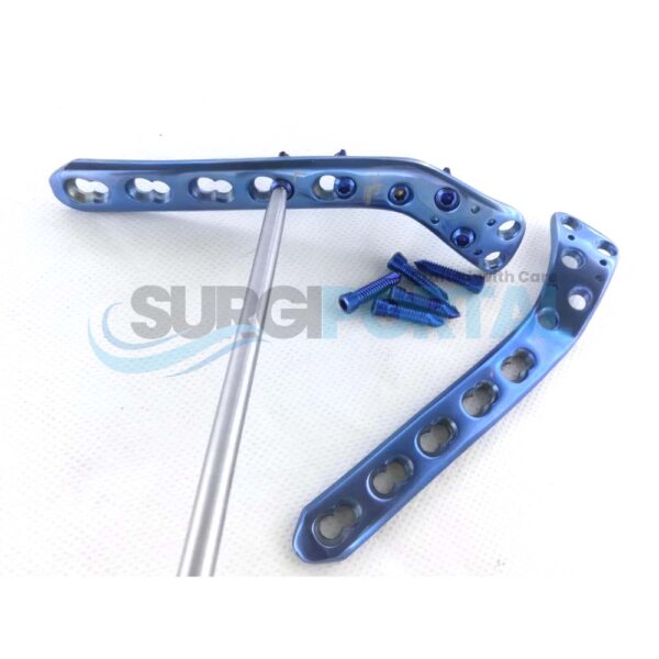 Proximal Lateral Tibia LCP Plates 4.5 5.0mm 5 11 Holes L R with Screws