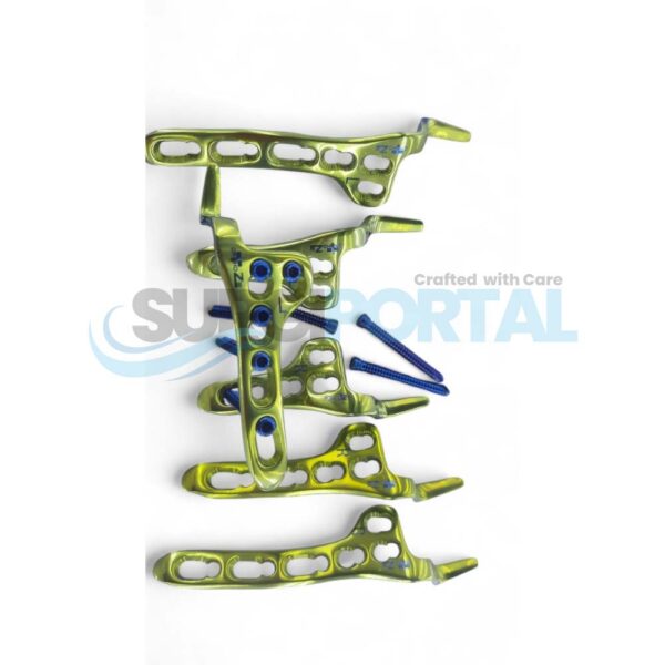 Locking Clavicle Hook Plate with Screws