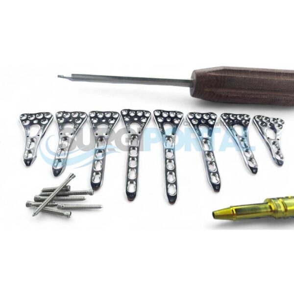 Locking Variable Angle Distal Radius Volar Plates with Screws Stainless Steel