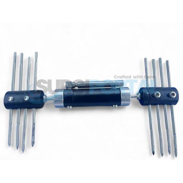 Procallus Fixator Orthofix External Fixator for Femur Fracture Recovery